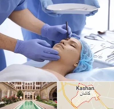 عمل بینی طبیعی در کاشان