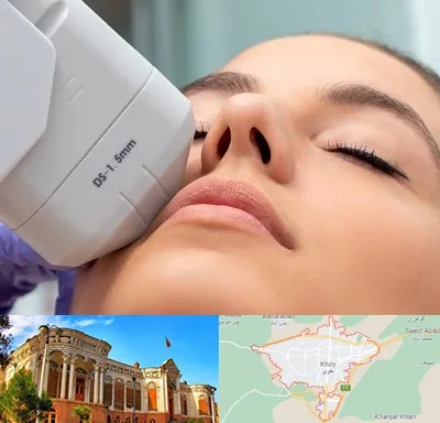 هایفوتراپی در خوی