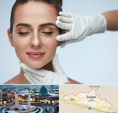 عمل پف چشم در زنجان