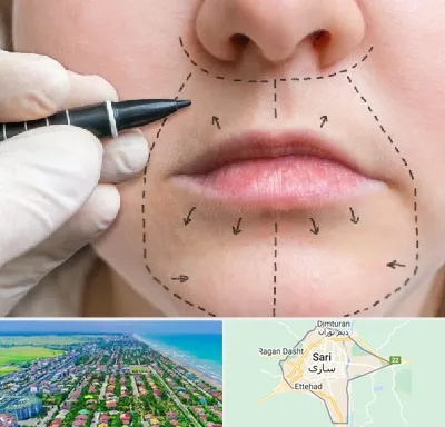 عمل سانترال لب در ساری