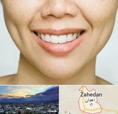 عمل چال گونه در زاهدان