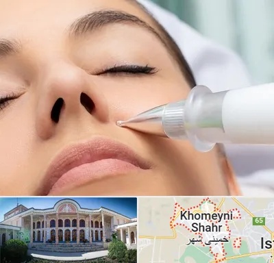 پلاسما جت بینی در خمینی شهر