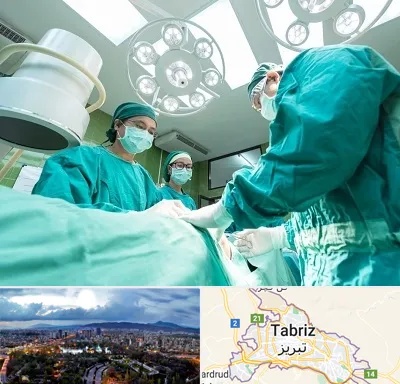 عمل تخلیه سینه در تبریز