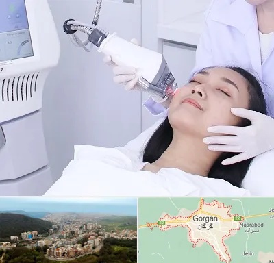 وایتنینگ در گرگان