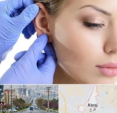 اتوپلاستی در گوهردشت کرج 