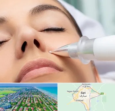 پلاسما جت بینی در ساری