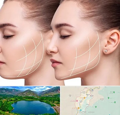 جراحی بوکال فت در رودبار