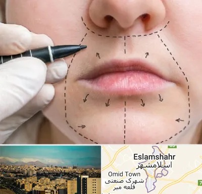 عمل سانترال لب در اسلامشهر