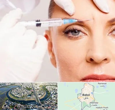 مزوژل در بابل