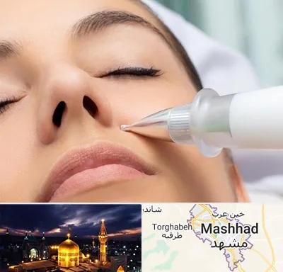 پلاسما جت بینی در مشهد