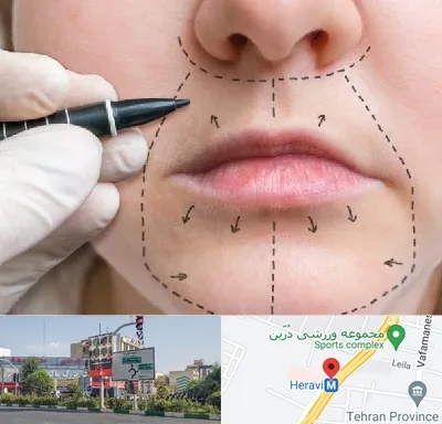 عمل سانترال لب در هروی 