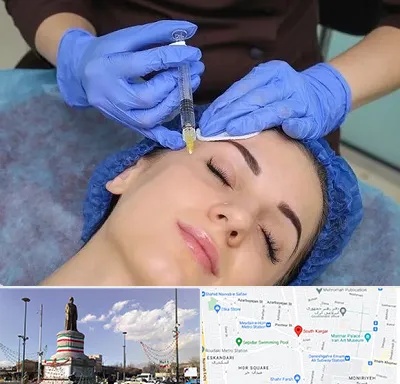 تزریق پروفایلو در کارگر جنوبی 
