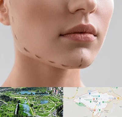 عمل زاویه فک در بجنورد
