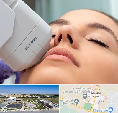 هایفوتراپی در ملارد