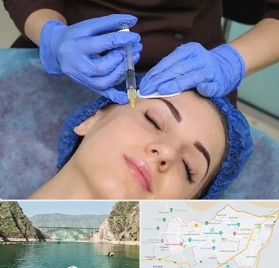 تزریق پروفایلو در ایلام