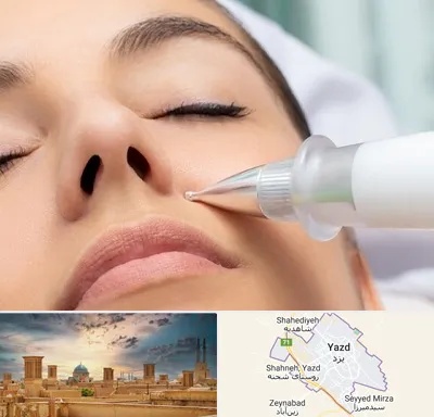پلاسما جت بینی در یزد
