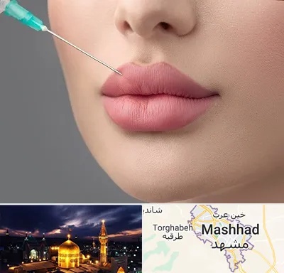 کلینیک ژل لب روسی در مشهد