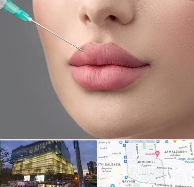 کلینیک ژل لب روسی در جمهوری 