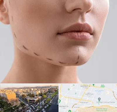 عمل زاویه فک در تهرانپارس 