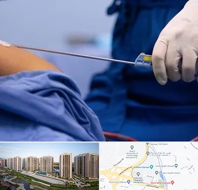 پیکر تراشی در المپیک 