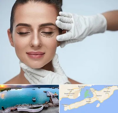عمل پف چشم در قشم