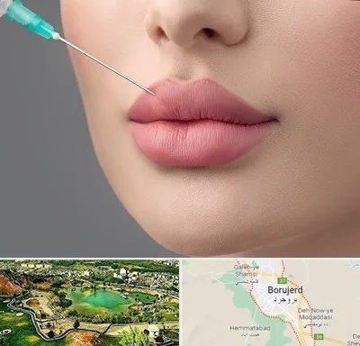 کلینیک ژل لب روسی در بروجرد