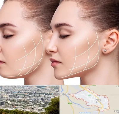 جراحی بوکال فت در یاسوج