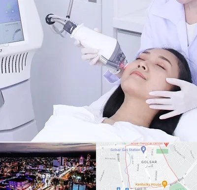 وایتنینگ در گلسار رشت 