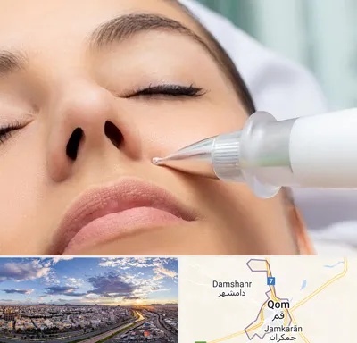 پلاسما جت بینی در قم