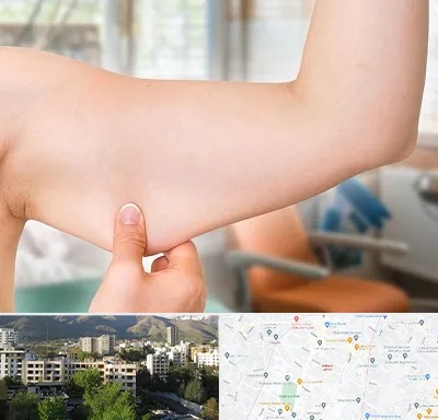 براکیوپلاستی در دیباجی 