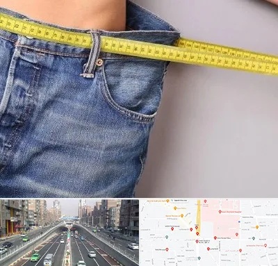 عمل لیپوماتیک در توحید 