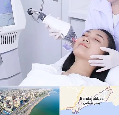 وایتنینگ در بندرعباس