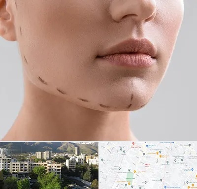 عمل زاویه فک در دیباجی 