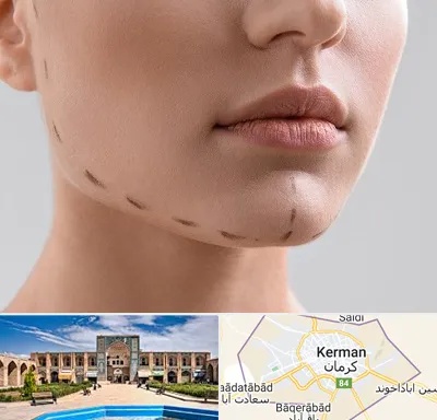 عمل زاویه فک در کرمان