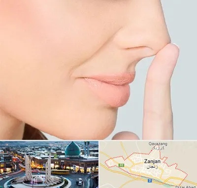 عمل تیپ پلاستی بینی در زنجان