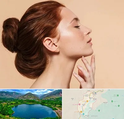 جراحی غبغب در رودبار