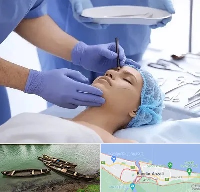 عمل بینی طبیعی در بندر انزلی