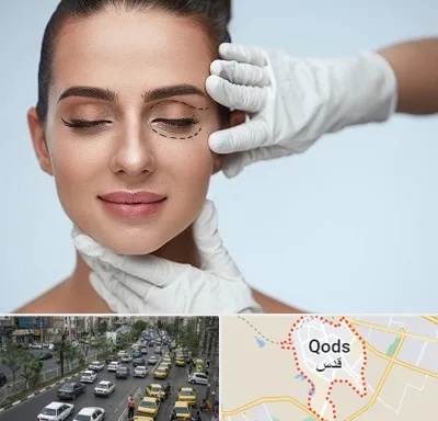 عمل پف چشم در شهر قدس