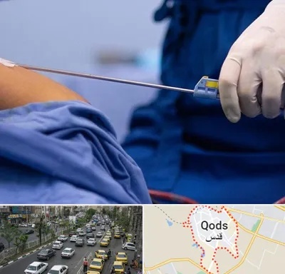 پیکر تراشی در شهر قدس
