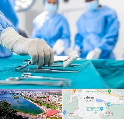 مونس پلاستی در لاهیجان