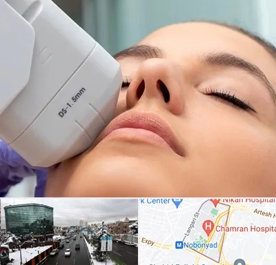 هایفوتراپی در اقدسیه 