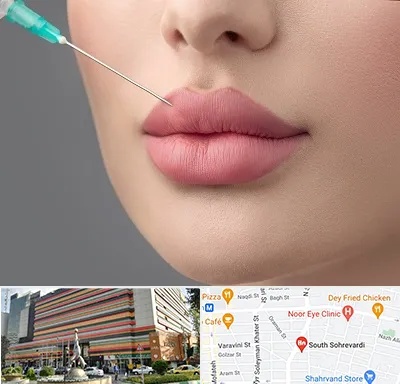 کلینیک ژل لب روسی در سهروردی 