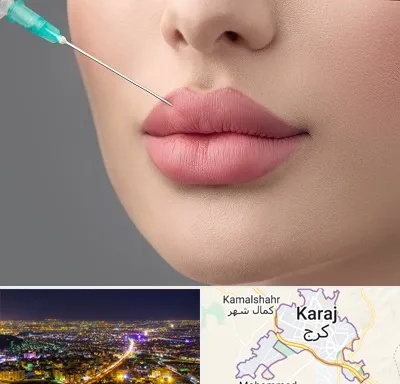 کلینیک ژل لب روسی در کرج