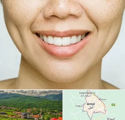 عمل چال گونه در آمل