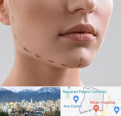 عمل زاویه فک در آجودانیه 