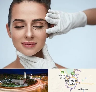 عمل پف چشم در همدان