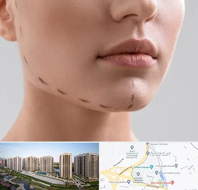 عمل زاویه فک در المپیک 