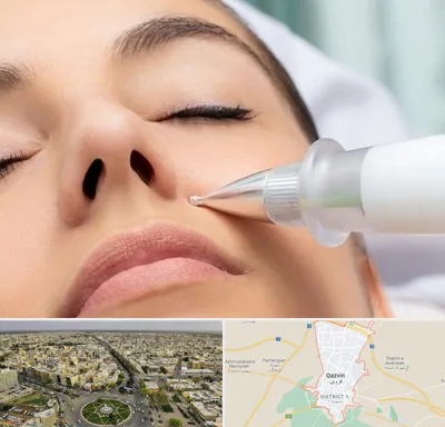 پلاسما جت بینی در قزوین
