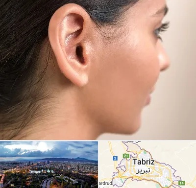 عمل گوش بل در تبریز