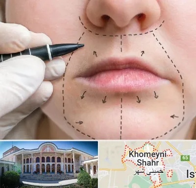 عمل سانترال لب در خمینی شهر